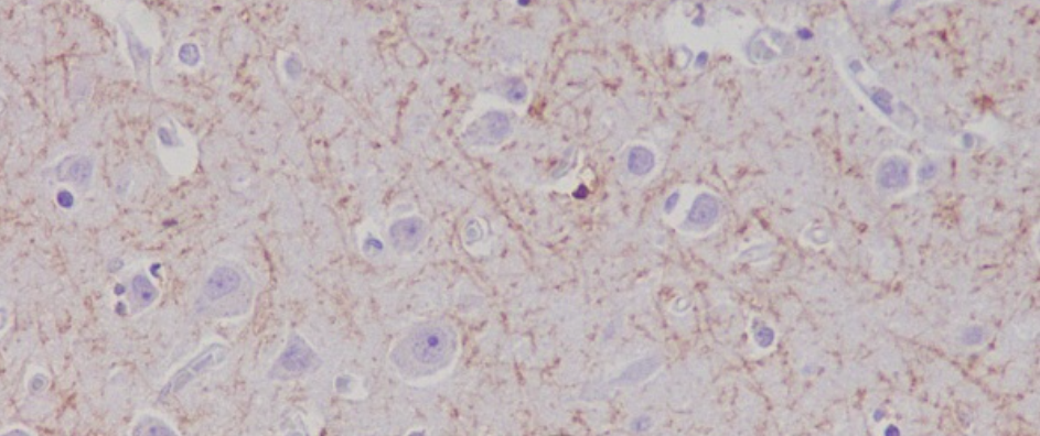 2 - Amyloid beta A4 Antibody  AP90292