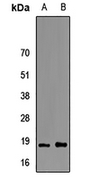1 - Anti-FABP6 Antibody AP93283