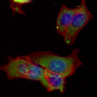 3 - Recombinant Anti-Periostin Rabbit mAb AP94852