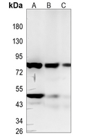 1 - Recombinant Anti-Periostin Rabbit mAb AP94852