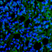 19 - Recombinant Anti-Smooth Muscle Actin Rabbit mAb AP94853