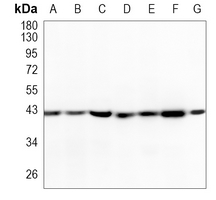 1 - Recombinant Anti-Smooth Muscle Actin Rabbit mAb AP94853