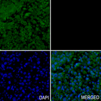 19 - Recombinant Anti-LOXL2 Rabbit mAb AP94855