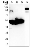 1 - Recombinant Anti-LOXL2 Rabbit mAb AP94855
