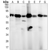 1 - Recombinant Anti-CD36L2 Rabbit mAb AP94856