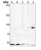 1 - Recombinant Anti-Villin Rabbit mAb AP94857