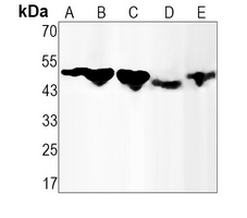 1 - Recombinant Anti-Alpha-1A Adrenergic Receptor Rabbit mAb AP94858