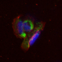 3 - Recombinant Anti-Osteopontin Rabbit mAb AP94859