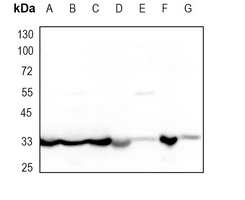 1 - Recombinant Anti-Osteopontin Rabbit mAb AP94859