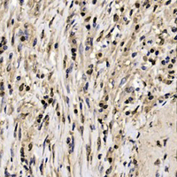 19 - Recombinant Anti-GAPDH Rabbit mAb AP94861