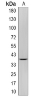 1 - Recombinant Anti-GAPDH Rabbit mAb AP94861