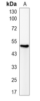 1 - Recombinant Anti-beta-Tubulin Rabbit mAb AP94862
