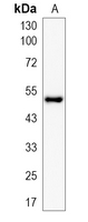1 - Recombinant Anti-alpha-Tubulin Rabbit mAb AP94863