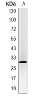 1 - Recombinant Anti-PCNA Rabbit mAb AP94864