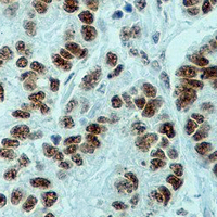 19 - Recombinant Anti-CREB (Phospho-S133) Rabbit mAb AP94869