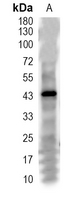 1 - Recombinant Anti-CREB (Phospho-S133) Rabbit mAb AP94869