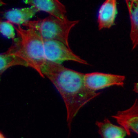 3 - Recombinant Anti-p53 Rabbit mAb AP94870