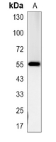 1 - Recombinant Anti-p53 Rabbit mAb AP94870