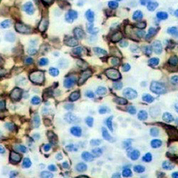 19 - Recombinant Anti-CD192 Rabbit mAb AP94871