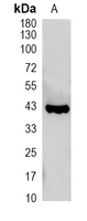 1 - Recombinant Anti-CD192 Rabbit mAb AP94871