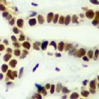 19 - Recombinant Anti-HDAC2 Rabbit mAb AP94873