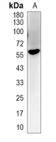 1 - Recombinant Anti-HDAC2 Rabbit mAb AP94873