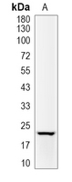 1 - Recombinant Anti-ID1 Rabbit mAb AP94874