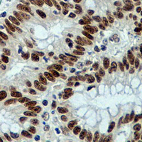 19 - Recombinant Anti-MLH1 Rabbit mAb AP94877