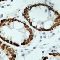 19 - Recombinant Anti-CDX2 Rabbit mAb AP94878