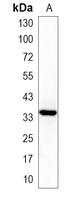 1 - Recombinant Anti-CDX2 Rabbit mAb AP94878