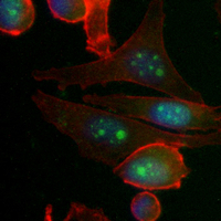 3 - Recombinant Anti-Histone H3 (DiMethyl-K4) Rabbit mAb AP94879