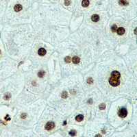 19 - Recombinant Anti-Histone H3 (DiMethyl-K4) Rabbit mAb AP94879