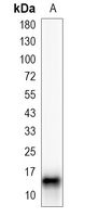 1 - Recombinant Anti-Histone H3 (DiMethyl-K4) Rabbit mAb AP94879