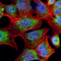 3 - Recombinant Anti-Filamin A Rabbit mAb AP94880