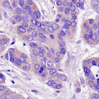 19 - Recombinant Anti-ATP1A1 Rabbit mAb AP94882