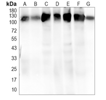 1 - Recombinant Anti-ATP1A1 Rabbit mAb AP94882