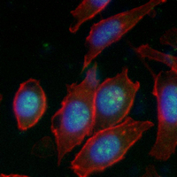 3 - Recombinant Anti-TIF1 beta Rabbit mAb AP94883
