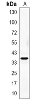 1 - Recombinant Anti-TorsinA Rabbit mAb AP94885