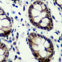 19 - Recombinant Anti-CK2 alpha Rabbit mAb AP94886