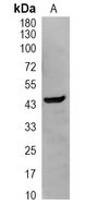 1 - Recombinant Anti-CK2 alpha Rabbit mAb AP94886