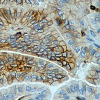 19 - Recombinant Anti-HLA-A Rabbit mAb AP94887