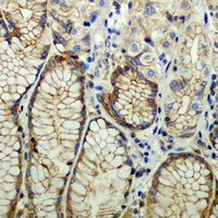 19 - Recombinant Anti-c-Met Rabbit mAb AP94889