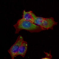 3 - Recombinant Anti-Beta Amyloid Rabbit mAb AP94891