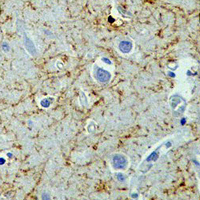 19 - Recombinant Anti-Beta Amyloid Rabbit mAb AP94891