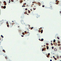 19 - Recombinant Anti-Histone H4 (Acetyl-K16) Rabbit mAb AP94892