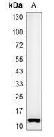 1 - Recombinant Anti-Histone H4 (Acetyl-K16) Rabbit mAb AP94892