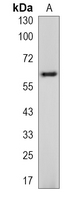 1 - Recombinant Anti-TCF7L1 Rabbit mAb AP94894