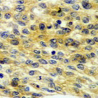19 - Recombinant Anti-BIM Rabbit mAb AP94895