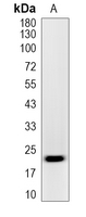 1 - Recombinant Anti-BIM Rabbit mAb AP94895