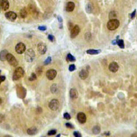 19 - Recombinant Anti-Beta-arrestin-1 Rabbit mAb AP94896